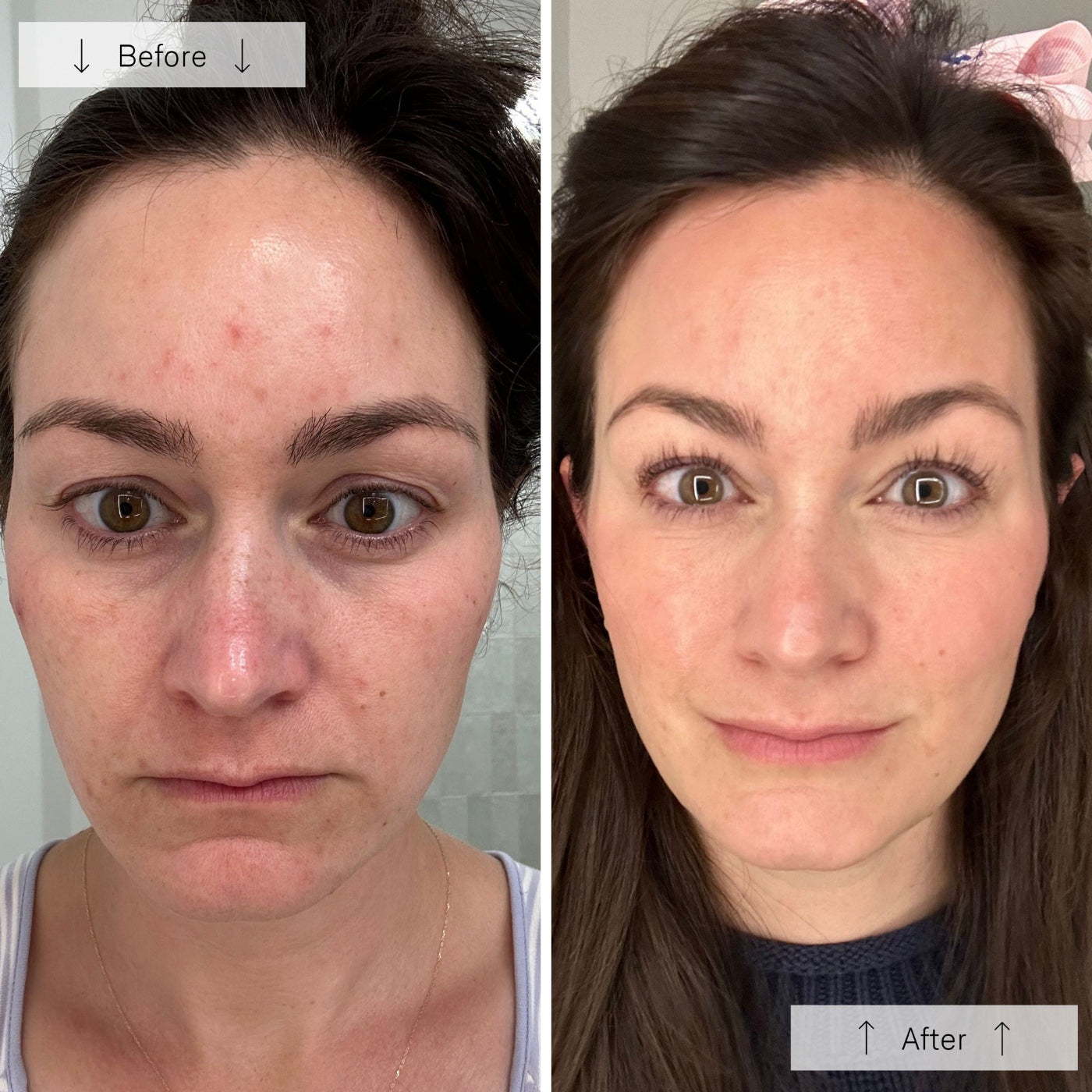 Omnilux Contour Face Mask